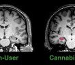 cannabis change the brain - HeadStuff.org