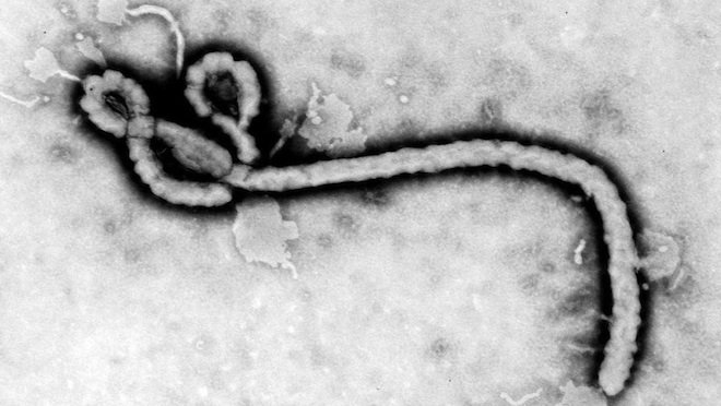New vaccine for the ebola virus might be on the way - Headstuff.org