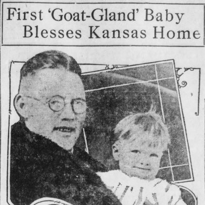 Newspaper coverage of Billy Stittsworth’s birth was what put Brinkley on the map, crushed animal testicles, man has son after transplant of goat testicles - HeadStuff.org