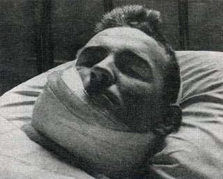 Nazi broadcaster William Joyce recovering from having his face slashed open by a razor - headstuff.org