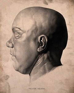 William Palmer's death mask - headstuff.org